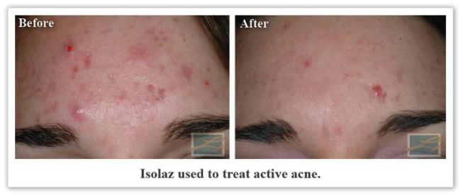 Isolaz New Orleans La- Dr Mary Lupo