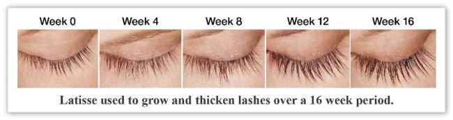 Latisse New Orleans LA Dr Mary Lupo