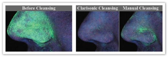 Before After cleansing