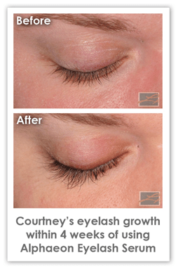 eye-slash-before-after