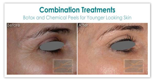 Combination Treatments