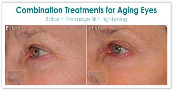 Combination eye for Aging Treatment