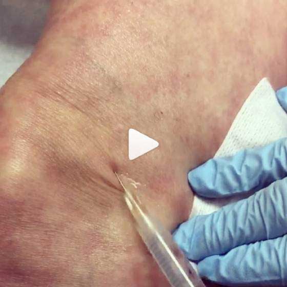  Treating Out of the Box: Above the Knee