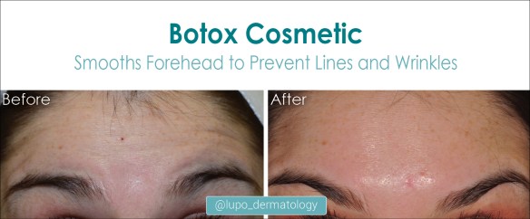 Botox Cosmetic