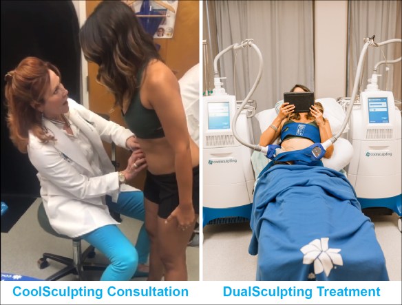  Experiences with CoolSculpting