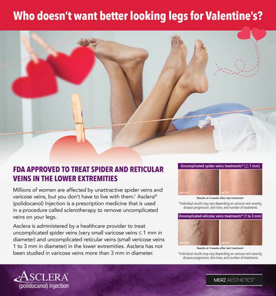 Say Bye Bye to Unwanted Leg Veins