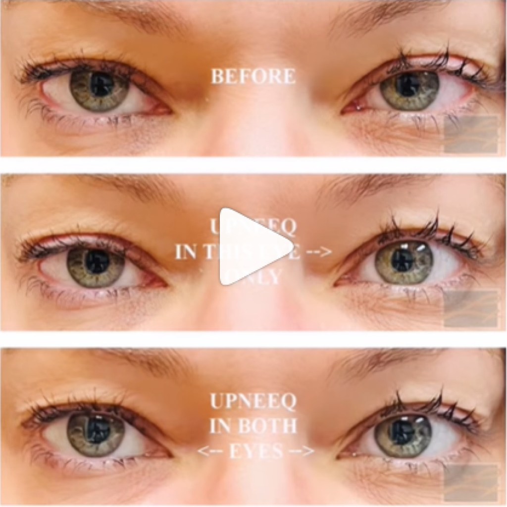 Upneeq Eye Drop Treatment Video
