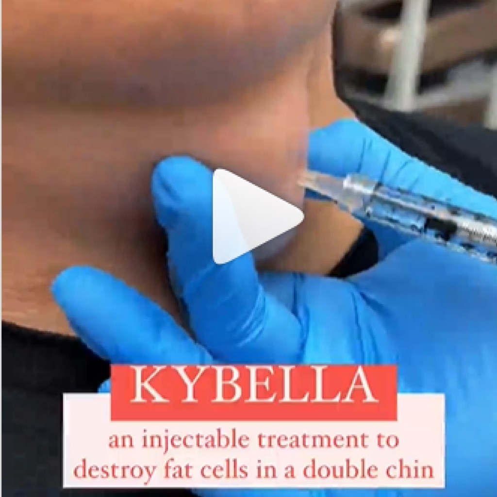 Dr. Lupo, Kybella Treatment Video.