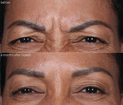 Before and After image 1