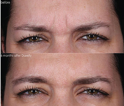 Before and After image 2